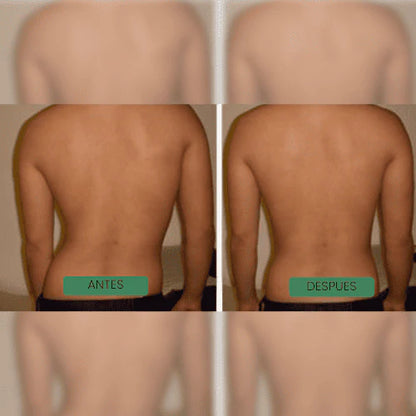 ComfortBack™ Corrector de postura ortopédico